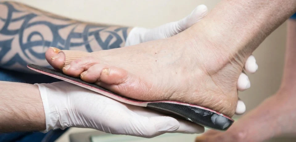 Custom Orthotics in Richmond bc