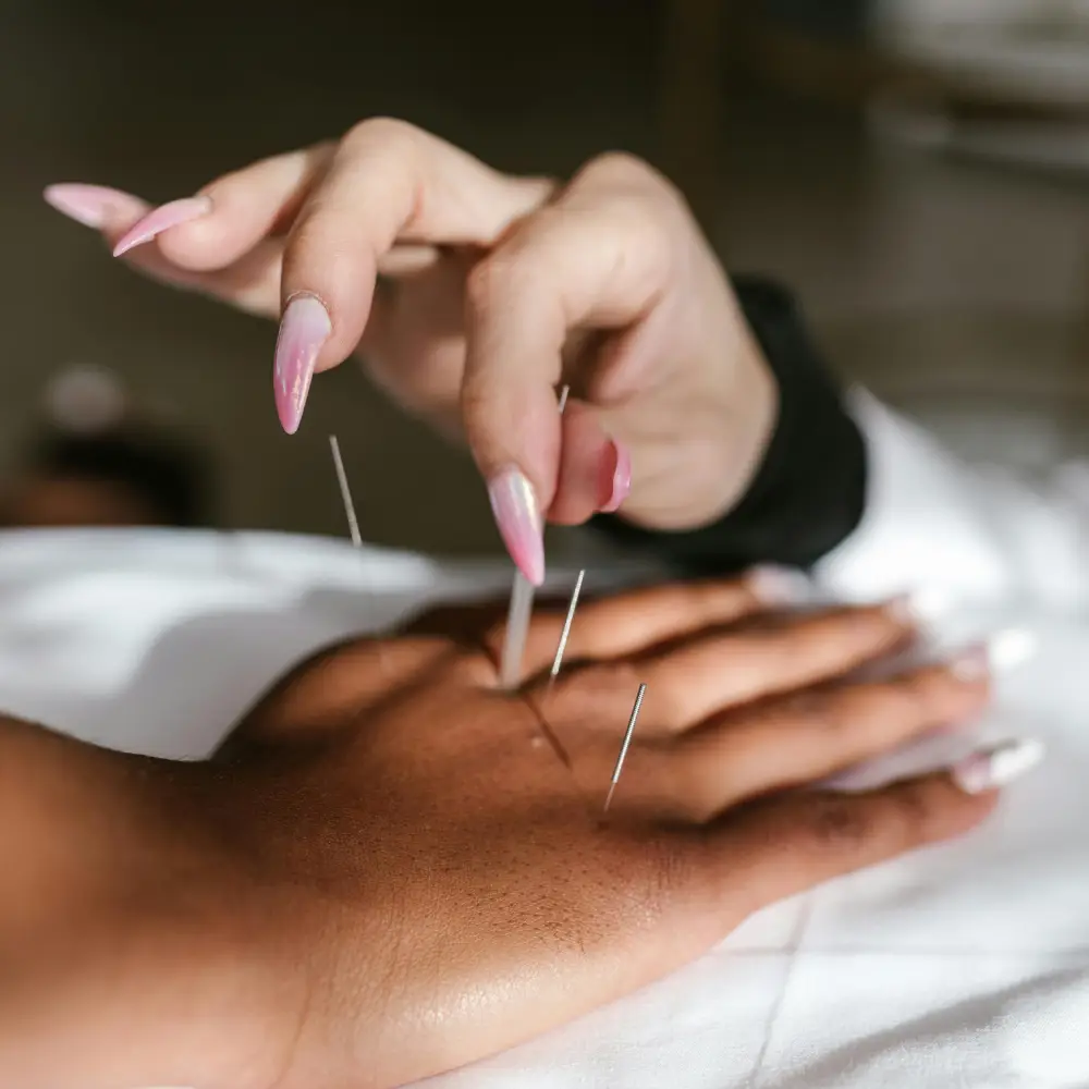 Acupuncture in Richmond