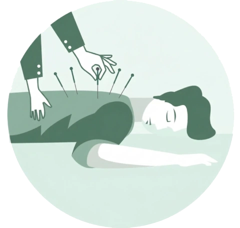 Acupuncture